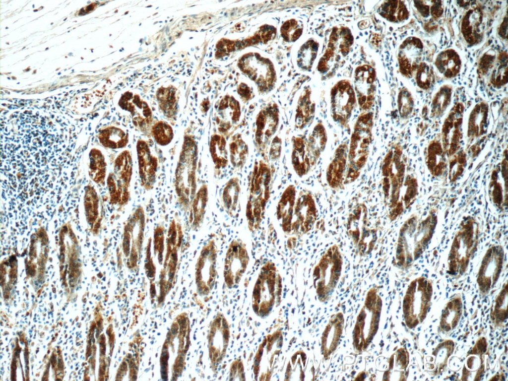 Immunohistochemistry (IHC) staining of human stomach tissue using RCCD1 Polyclonal antibody (24446-1-AP)