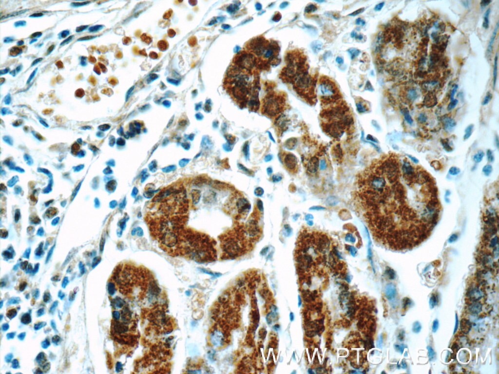 Immunohistochemistry (IHC) staining of human stomach tissue using RCCD1 Polyclonal antibody (24446-1-AP)