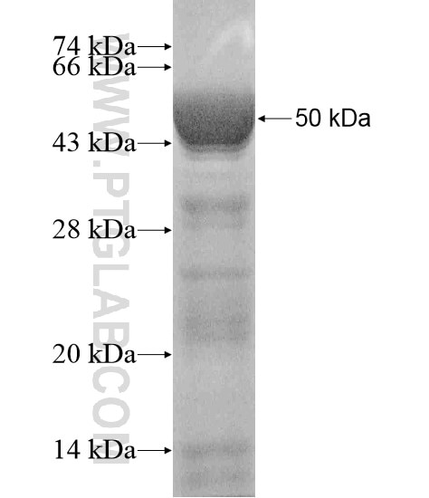 RCCD1 fusion protein Ag19685 SDS-PAGE