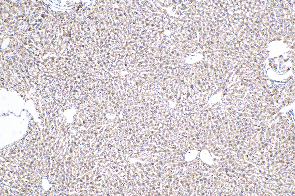Immunohistochemistry (IHC) staining of mouse liver tissue using Pirh2 Polyclonal antibody (13820-1-AP)