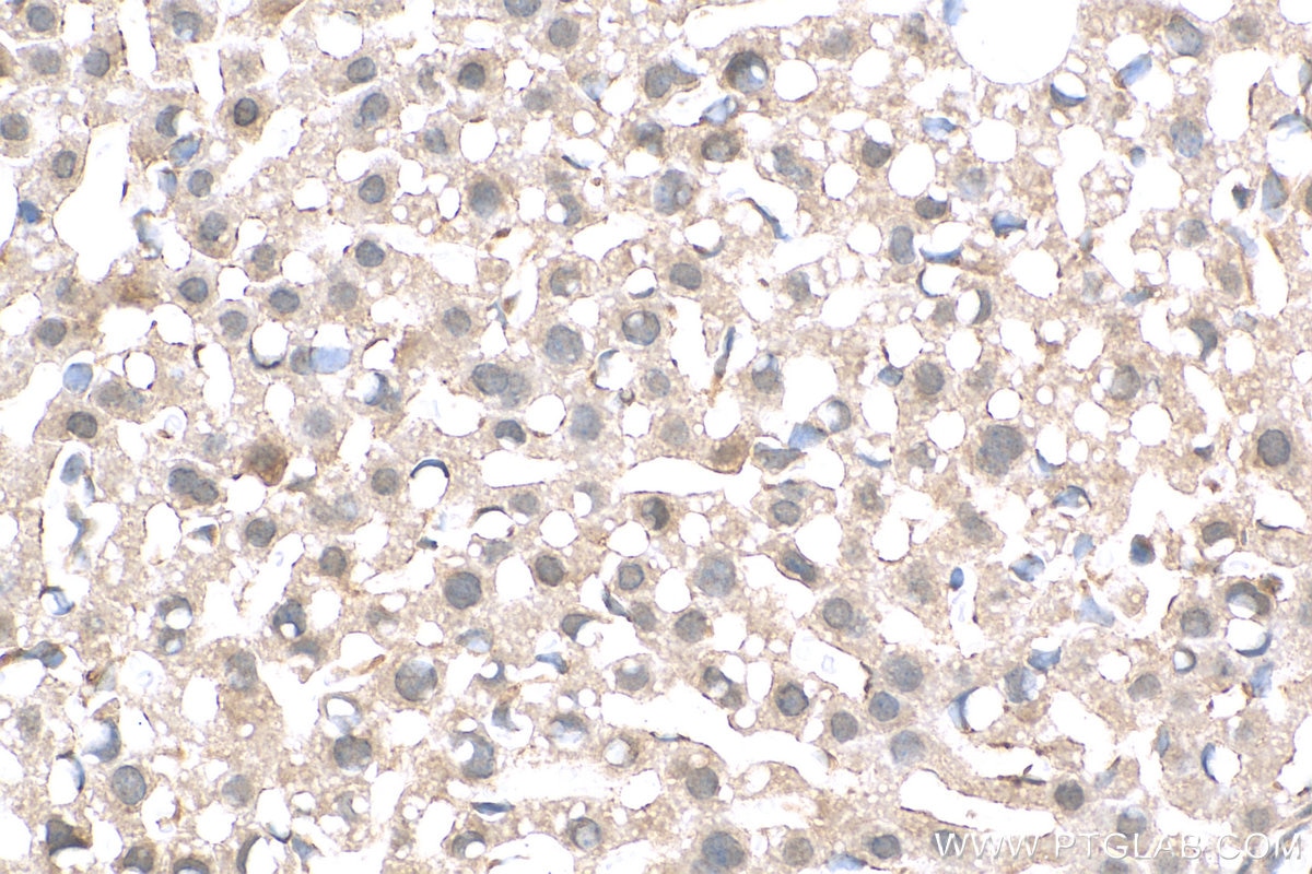 Immunohistochemistry (IHC) staining of mouse liver tissue using Pirh2 Polyclonal antibody (13820-1-AP)