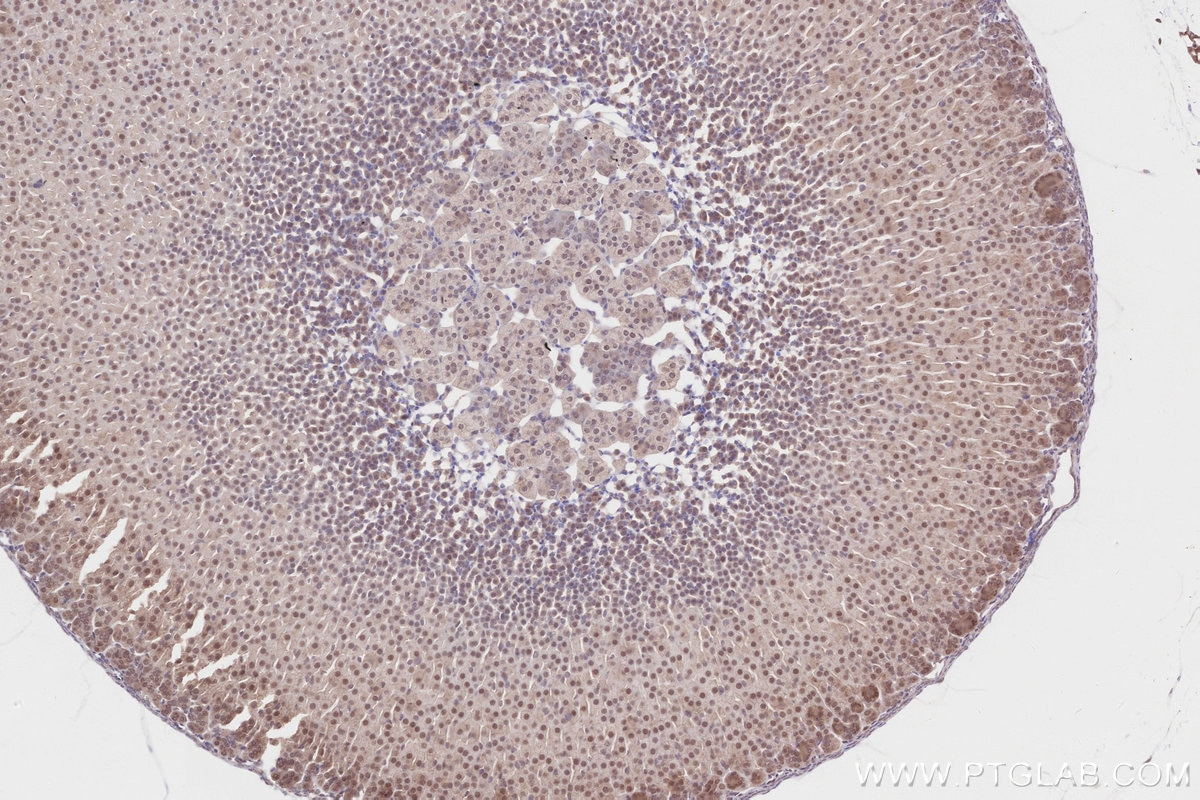 Immunohistochemistry (IHC) staining of mouse adrenal gland tissue using Pirh2 Polyclonal antibody (13820-1-AP)