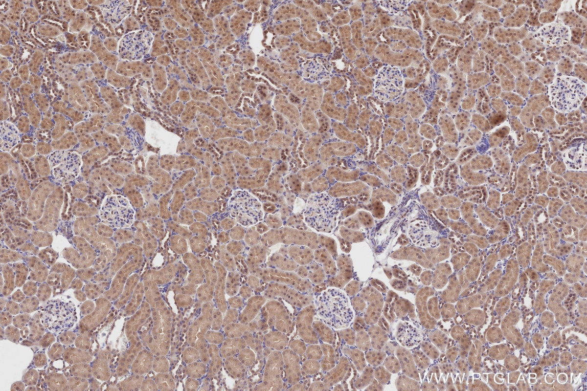 Immunohistochemistry (IHC) staining of rat kidney tissue using Pirh2 Polyclonal antibody (13820-1-AP)