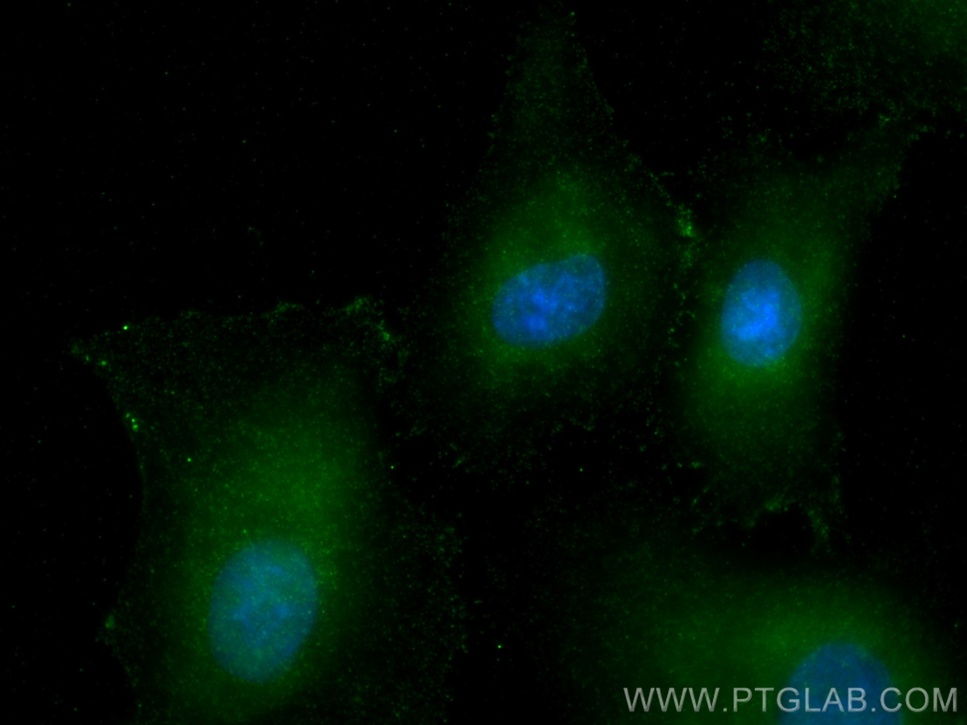 Immunofluorescence (IF) / fluorescent staining of A549 cells using RCHY1 Monoclonal antibody (67856-1-Ig)