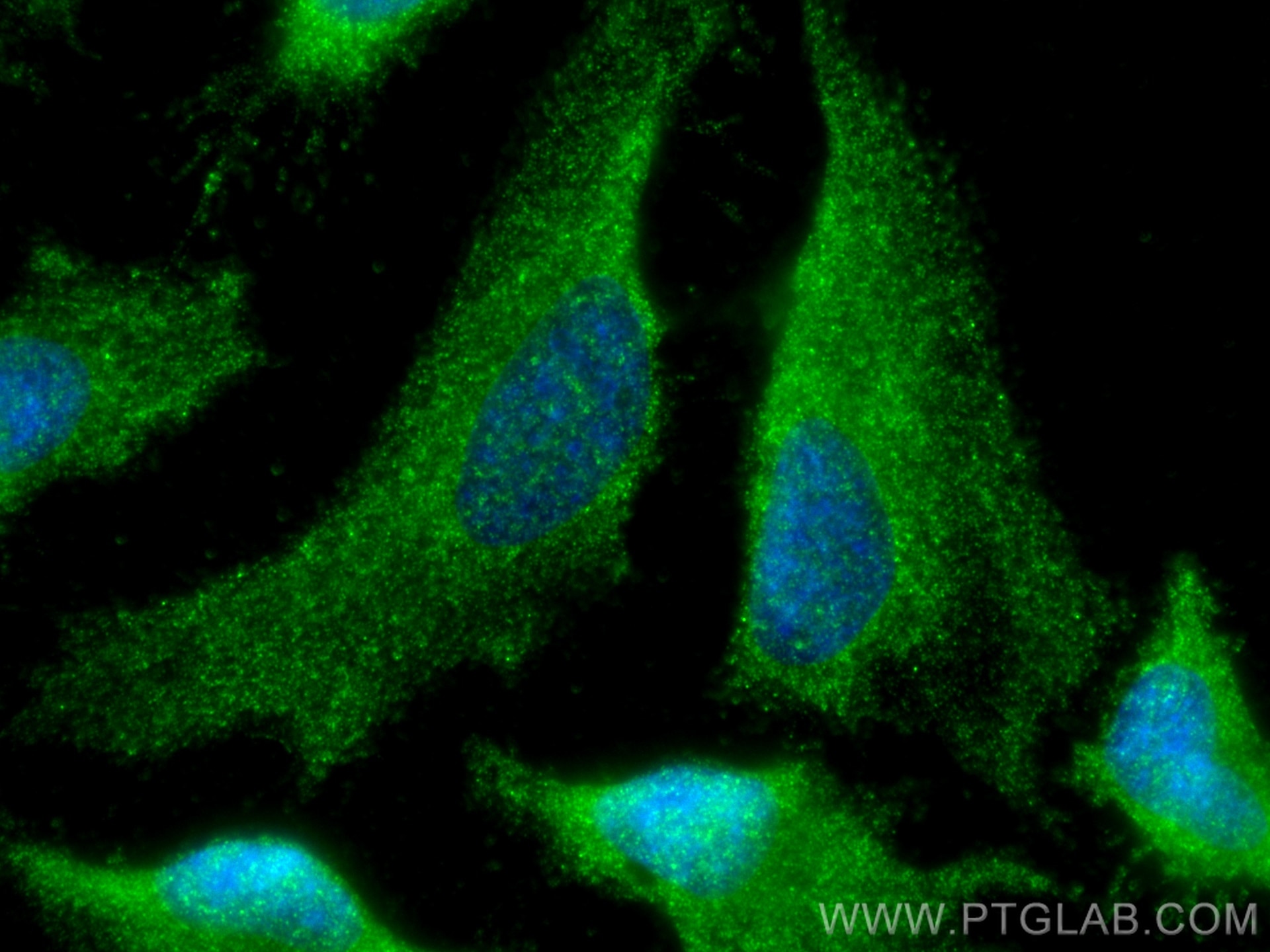 Immunofluorescence (IF) / fluorescent staining of HeLa cells using RCHY1 Monoclonal antibody (67856-1-Ig)