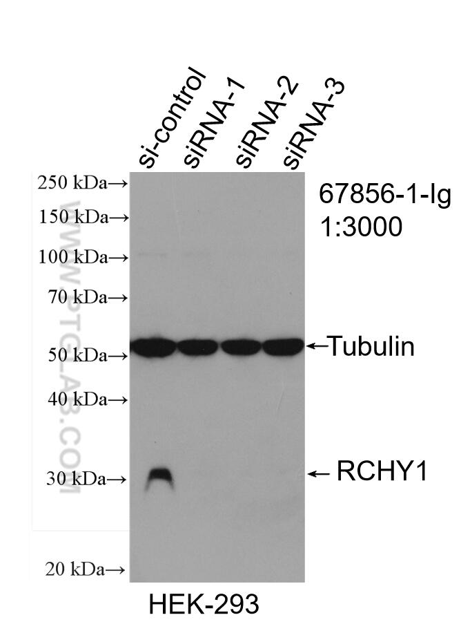 Western Blot (WB) analysis of HEK-293 cells using RCHY1 Monoclonal antibody (67856-1-Ig)
