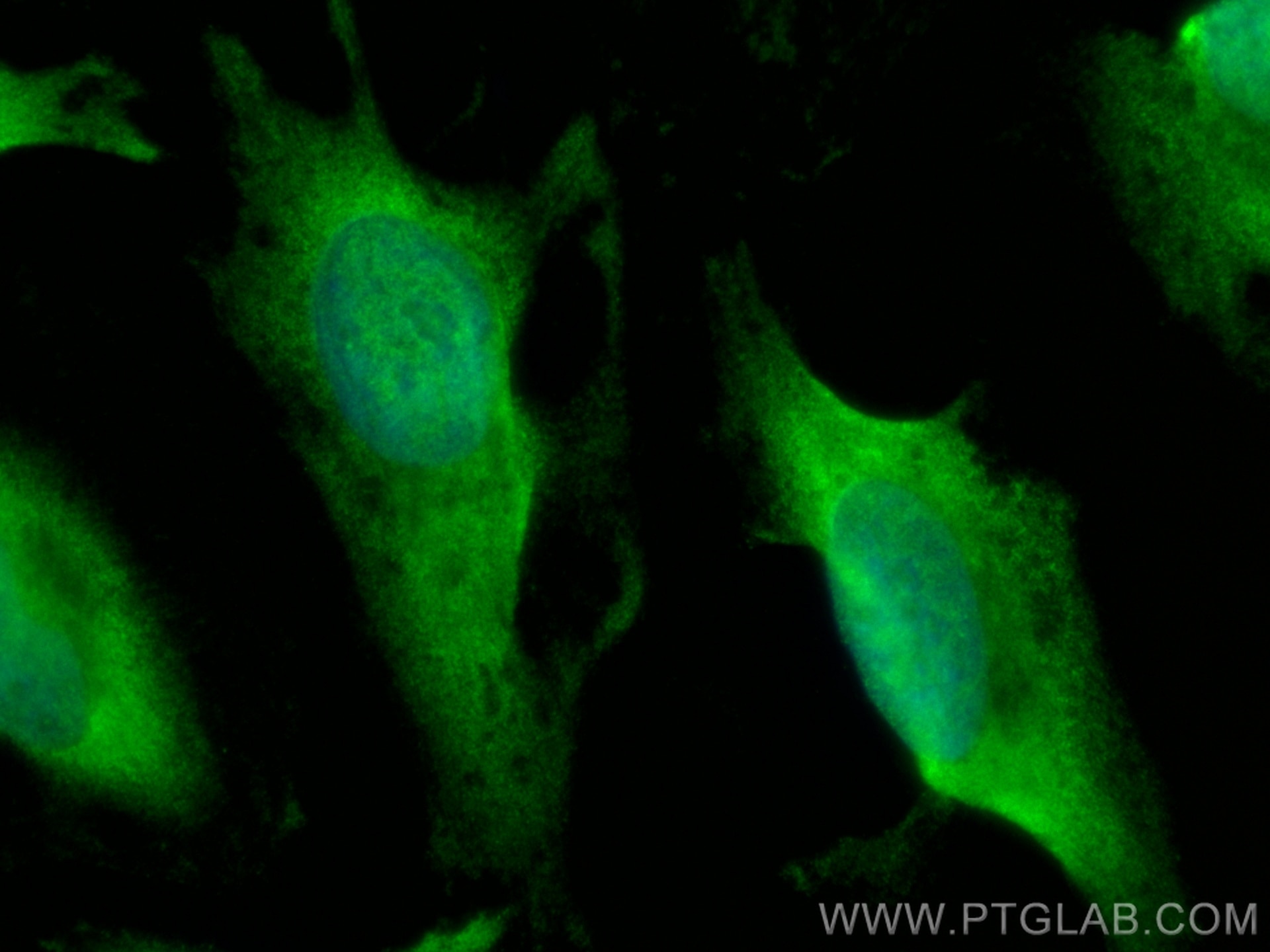 Immunofluorescence (IF) / fluorescent staining of HeLa cells using CoraLite® Plus 488-conjugated RCHY1 Monoclonal ant (CL488-67856)