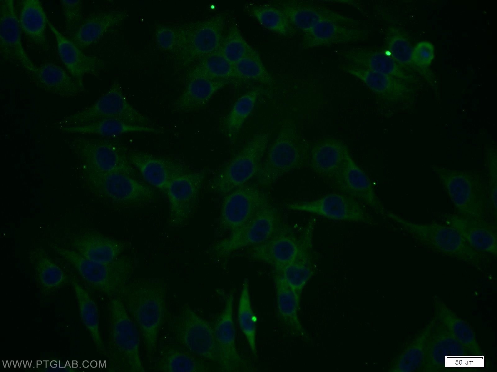 Immunofluorescence (IF) / fluorescent staining of A375 cells using RCL1 Polyclonal antibody (15330-1-AP)