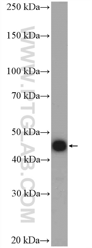 Western Blot (WB) analysis of A431 cells using RCL1 Polyclonal antibody (15330-1-AP)