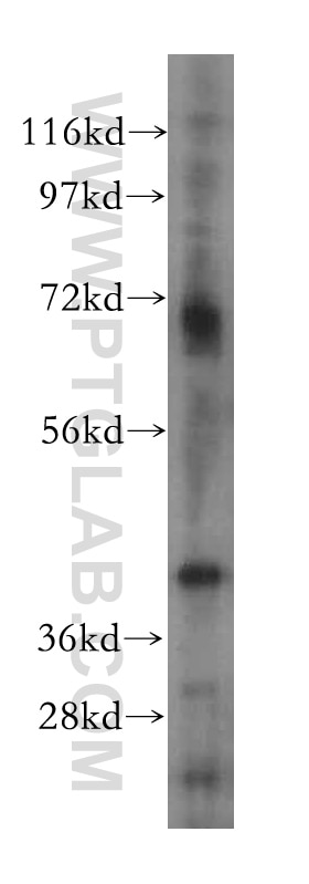 Western Blot (WB) analysis of HepG2 cells using RCL1 Polyclonal antibody (15330-1-AP)