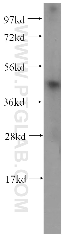 Western Blot (WB) analysis of A375 cells using RCL1 Polyclonal antibody (15330-1-AP)