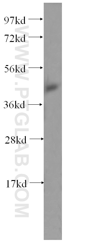 WB analysis of A431 using 15330-1-AP