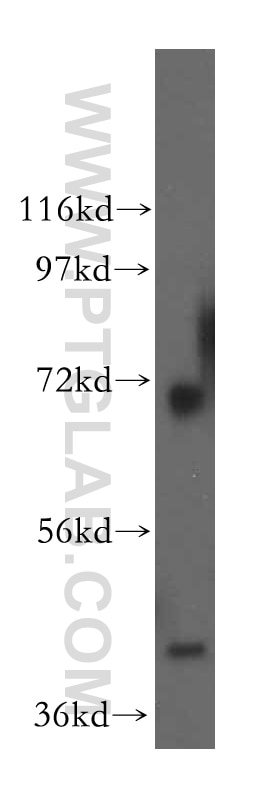 Western Blot (WB) analysis of MCF-7 cells using RCL1 Polyclonal antibody (15330-1-AP)