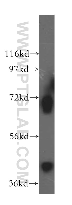 Western Blot (WB) analysis of A375 cells using RCL1 Polyclonal antibody (15330-1-AP)
