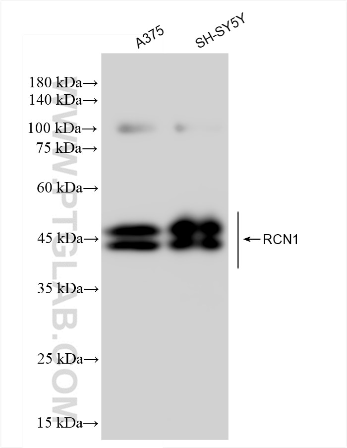 Western Blot (WB) analysis of various lysates using RCN1 Recombinant antibody (83638-3-RR)