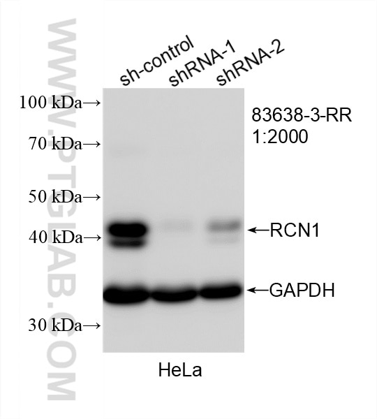Western Blot (WB) analysis of HeLa cells using RCN1 Recombinant antibody (83638-3-RR)