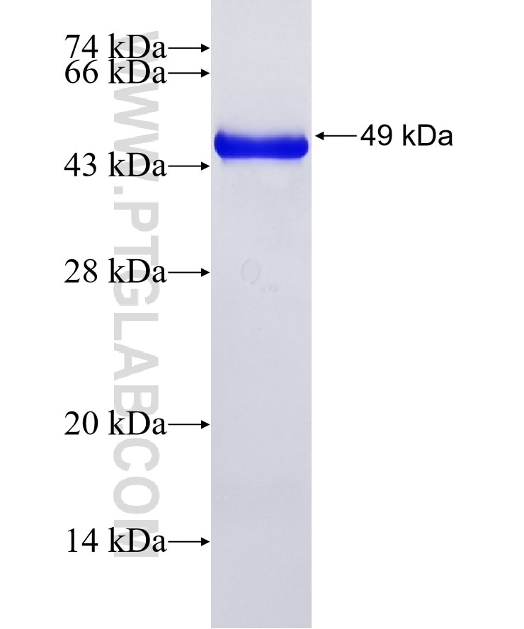 RCN1 fusion protein Ag13308 SDS-PAGE