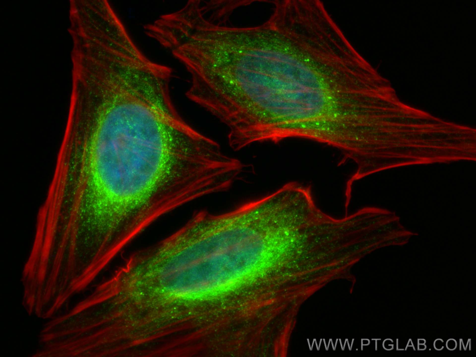 Immunofluorescence (IF) / fluorescent staining of HeLa cells using RCN2 Polyclonal antibody (10193-2-AP)