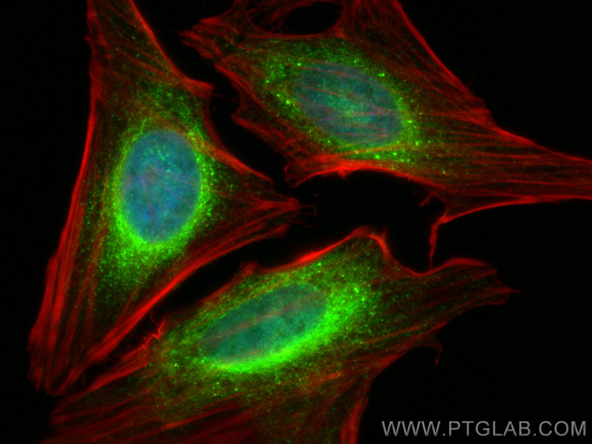 IF Staining of HeLa using 10193-2-AP