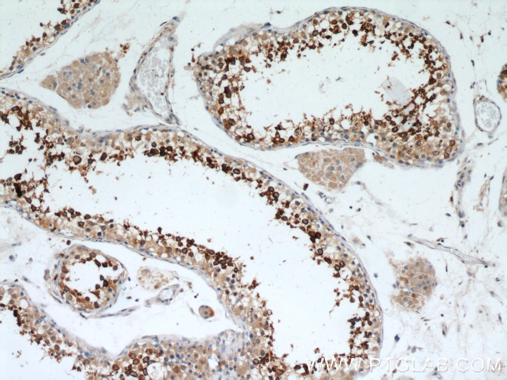 IHC staining of human testis using 10193-2-AP