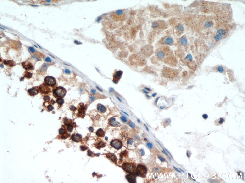 IHC staining of human testis using 10193-2-AP