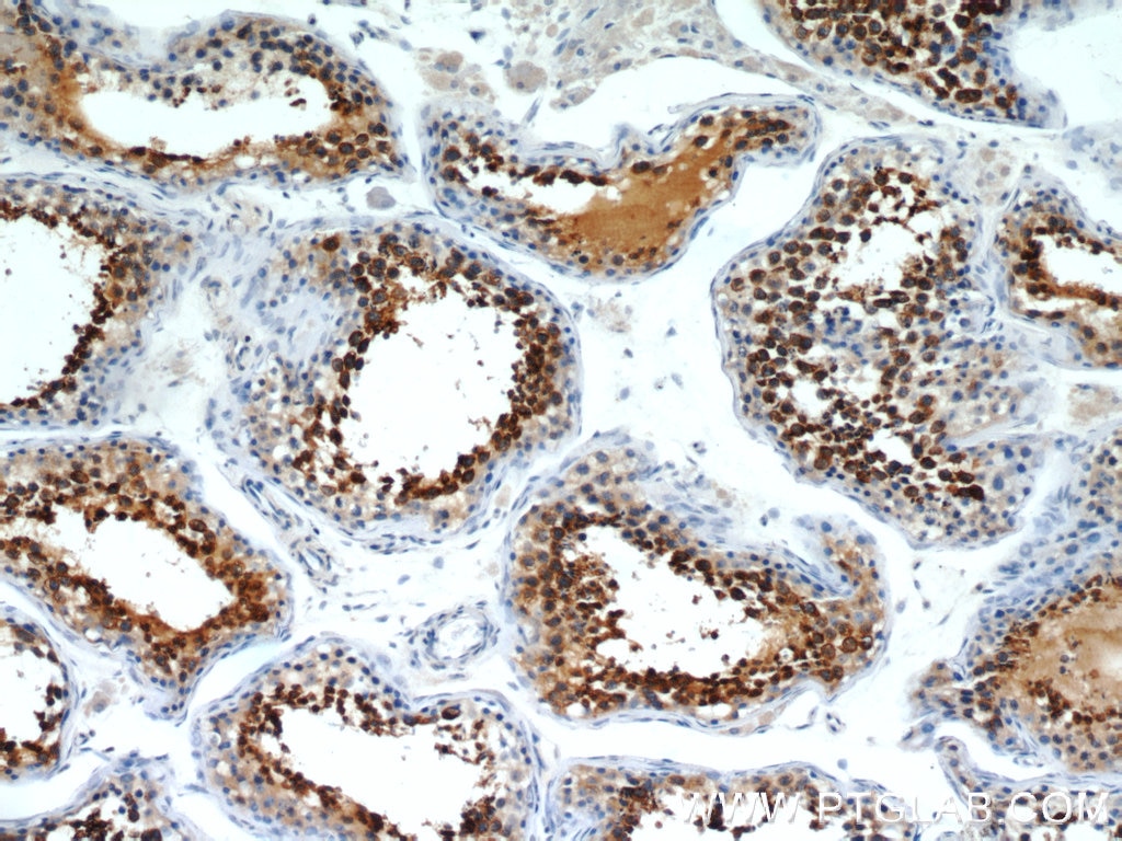 Immunohistochemistry (IHC) staining of human testis tissue using RCN2 Polyclonal antibody (10193-2-AP)