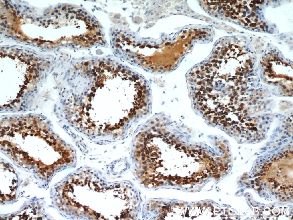 IHC staining of human testis using 10193-2-AP