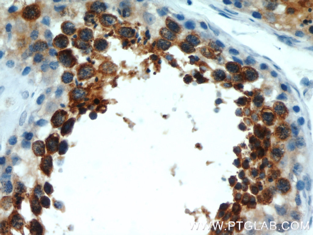 Immunohistochemistry (IHC) staining of human testis tissue using RCN2 Polyclonal antibody (10193-2-AP)