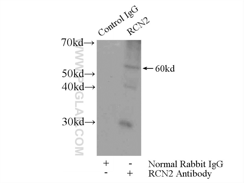Immunoprecipitation (IP) experiment of mouse lung tissue using RCN2 Polyclonal antibody (10193-2-AP)
