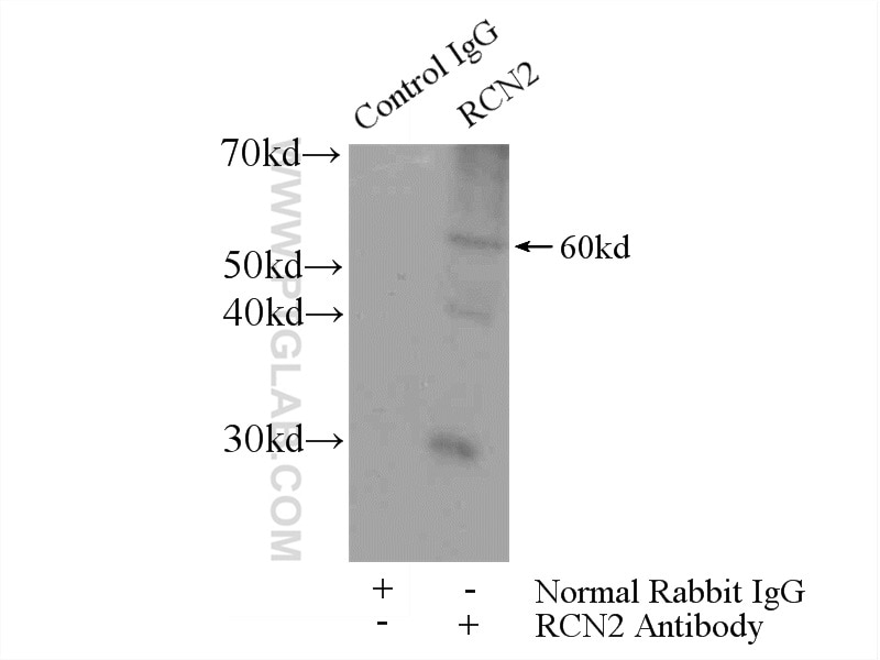 IP experiment of mouse lung using 10193-2-AP