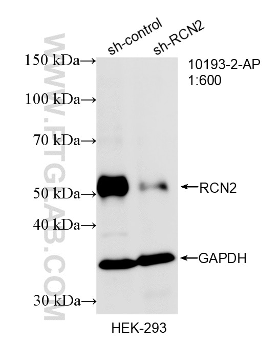 Western Blot (WB) analysis of HEK-293 cells using RCN2 Polyclonal antibody (10193-2-AP)