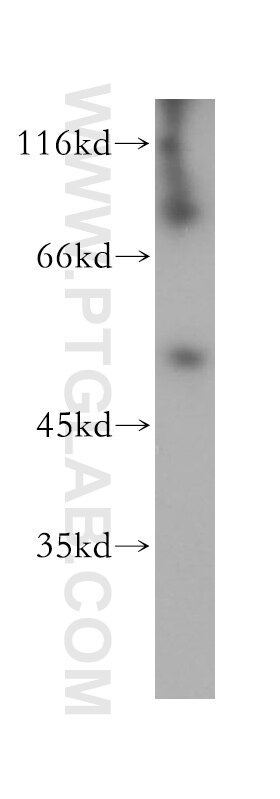 Western Blot (WB) analysis of mouse lung tissue using RCN2 Polyclonal antibody (10193-2-AP)