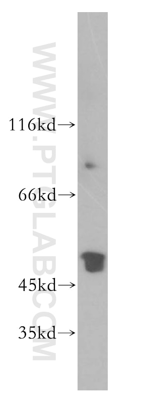 Western Blot (WB) analysis of human brain tissue using RCN2 Polyclonal antibody (10193-2-AP)