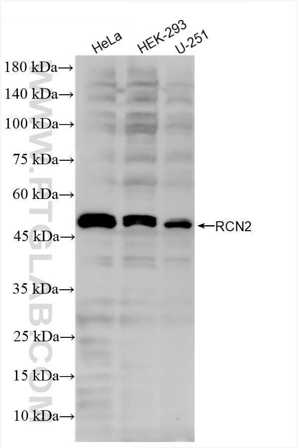 Western Blot (WB) analysis of various lysates using RCN2 Recombinant antibody (84956-4-RR)