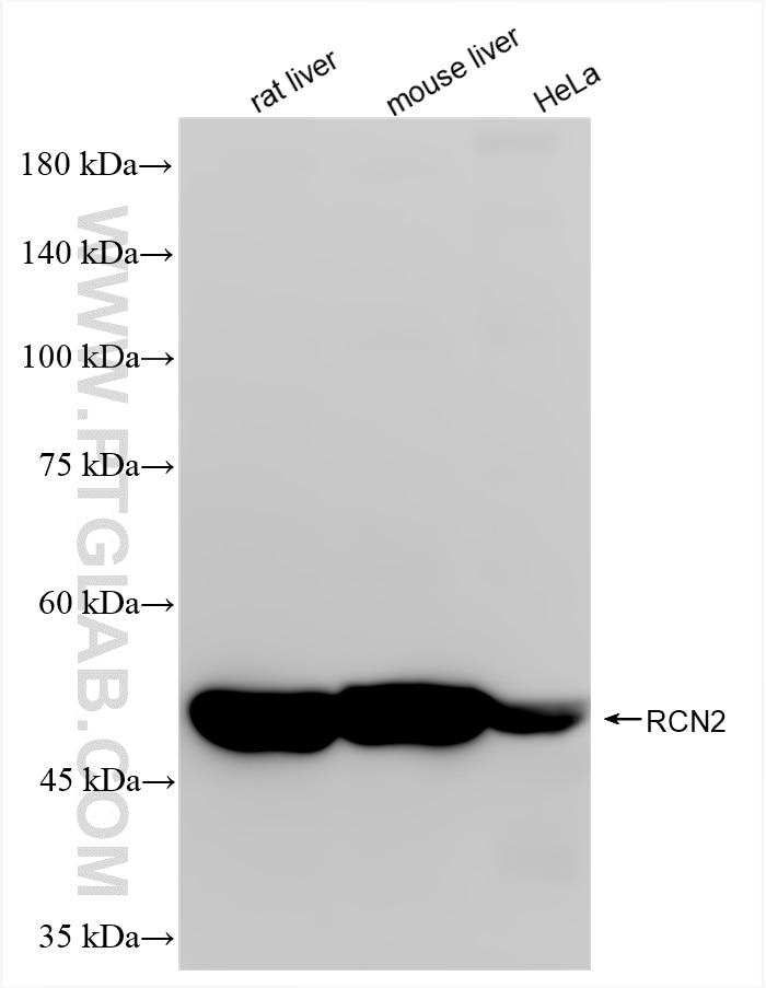 Western Blot (WB) analysis of various lysates using RCN2 Recombinant antibody (84956-4-RR)