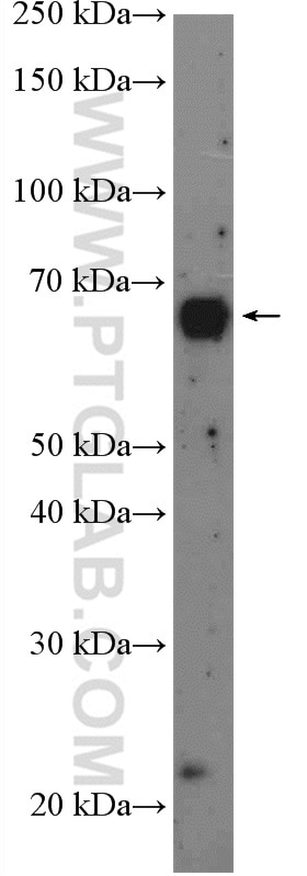 Western Blot (WB) analysis of C2C12 cells using RCOR1 Polyclonal antibody (27686-1-AP)