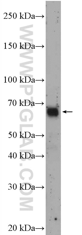 Western Blot (WB) analysis of PC-12 cells using RCOR1 Polyclonal antibody (27686-1-AP)