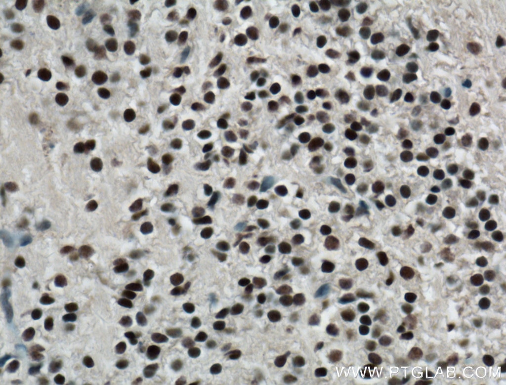 Immunohistochemistry (IHC) staining of mouse embryo tissue using RCOR2 Polyclonal antibody (23969-1-AP)