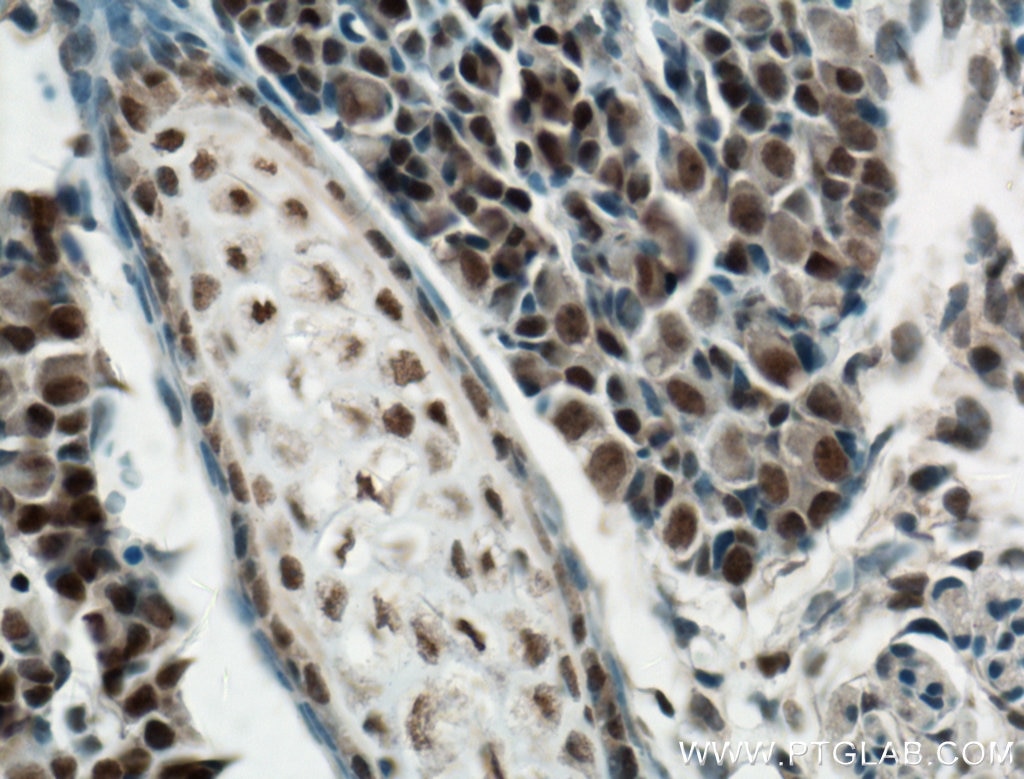 Immunohistochemistry (IHC) staining of mouse embryo tissue using RCOR2 Polyclonal antibody (23969-1-AP)