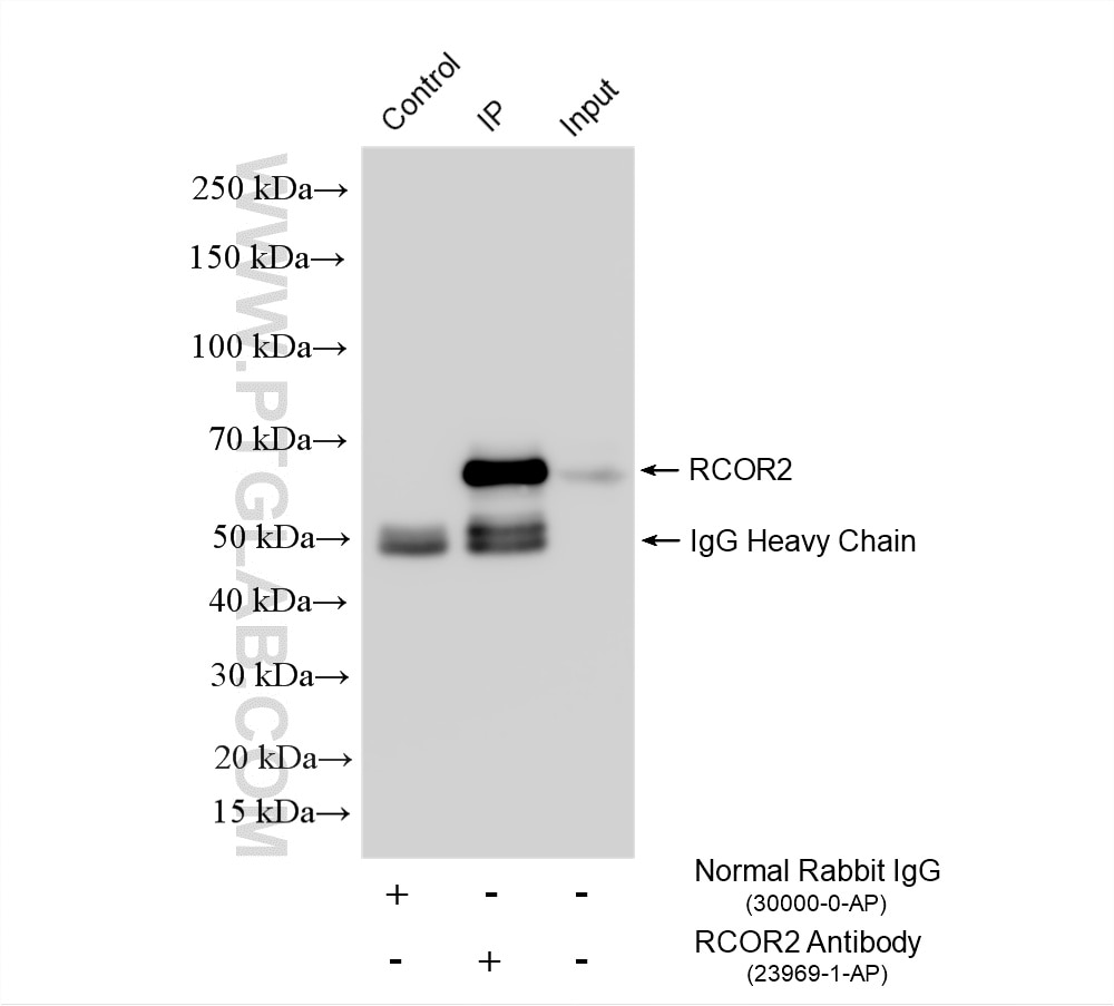 Immunoprecipitation (IP) experiment of HEK-293 cells using RCOR2 Polyclonal antibody (23969-1-AP)