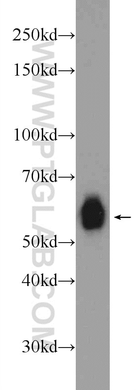 Western Blot (WB) analysis of Jurkat cells using RCOR2 Polyclonal antibody (23969-1-AP)