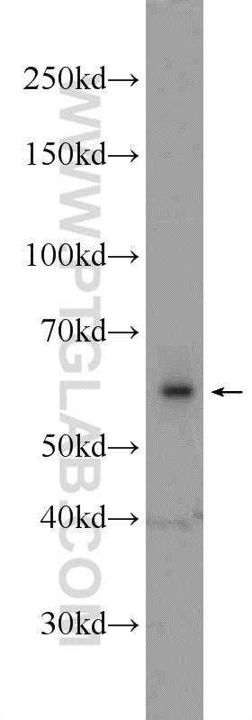Western Blot (WB) analysis of HEK-293 cells using RCOR2 Polyclonal antibody (23969-1-AP)
