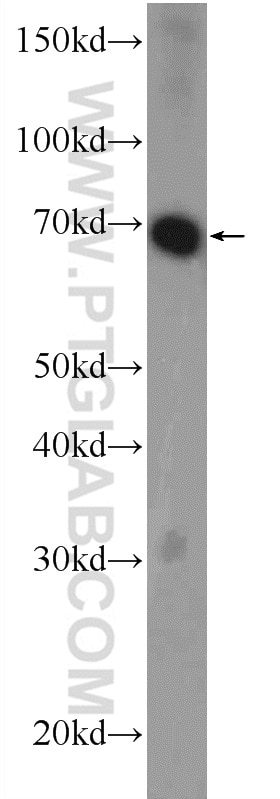 WB analysis of mouse brain using 25970-1-AP