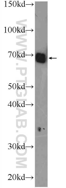 Western Blot (WB) analysis of rat brain tissue using RCOR3 Polyclonal antibody (25970-1-AP)