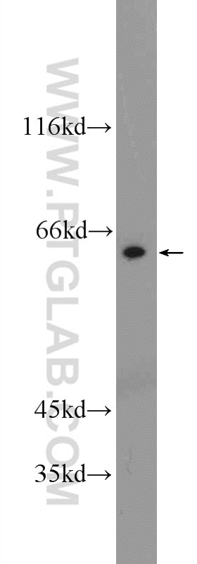 Western Blot (WB) analysis of A431 cells using RCOR3 Polyclonal antibody (55173-1-AP)