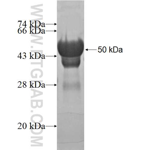 RCSD1 fusion protein Ag3106 SDS-PAGE