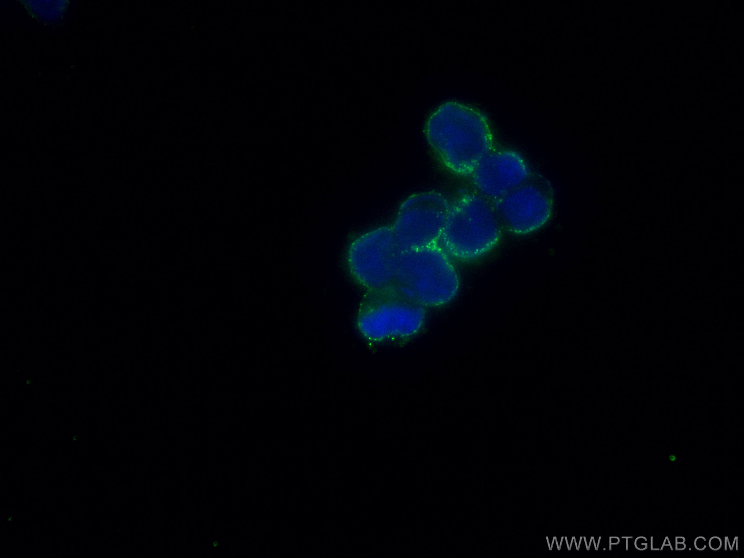 Immunofluorescence (IF) / fluorescent staining of Y79 cells using Recoverin Polyclonal antibody (10073-1-AP)