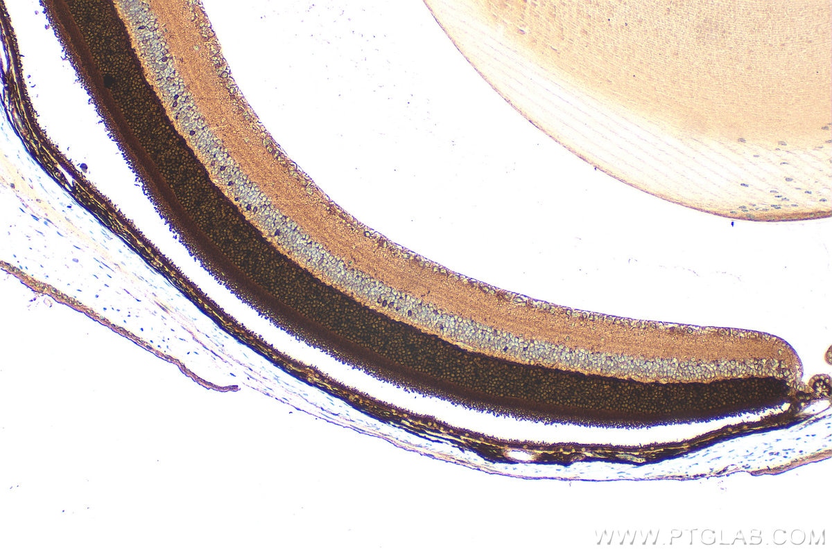 Immunohistochemical analysis of paraffin-embedded mouse eye tissue slide using 10073-1-AP (Recoverin antibody) at dilution of 1:200 (under 10x lens). Heat mediated antigen retrieval with Tris-EDTA buffer (pH 9.0). Immunohistochemistry (IHC) staining of mouse eye tissue using Recoverin Polyclonal antibody (10073-1-AP)