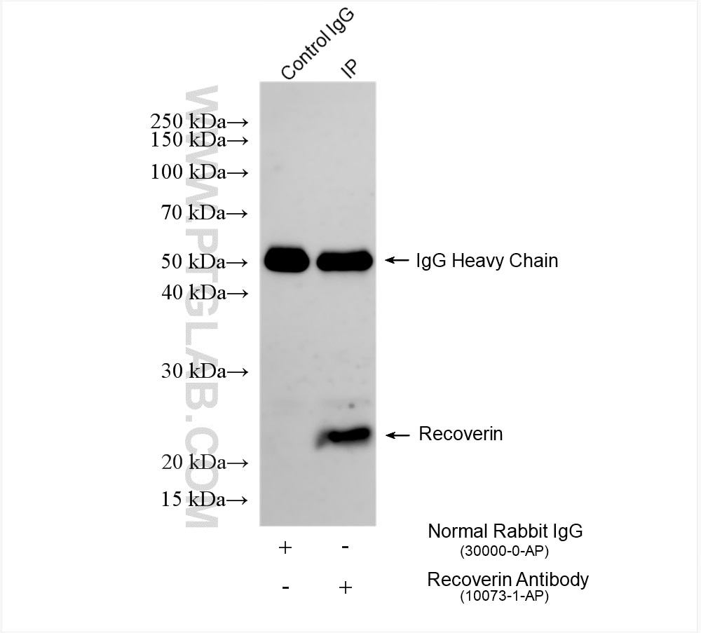 Immunoprecipitation (IP) experiment of mouse eye tissue using Recoverin Polyclonal antibody (10073-1-AP)