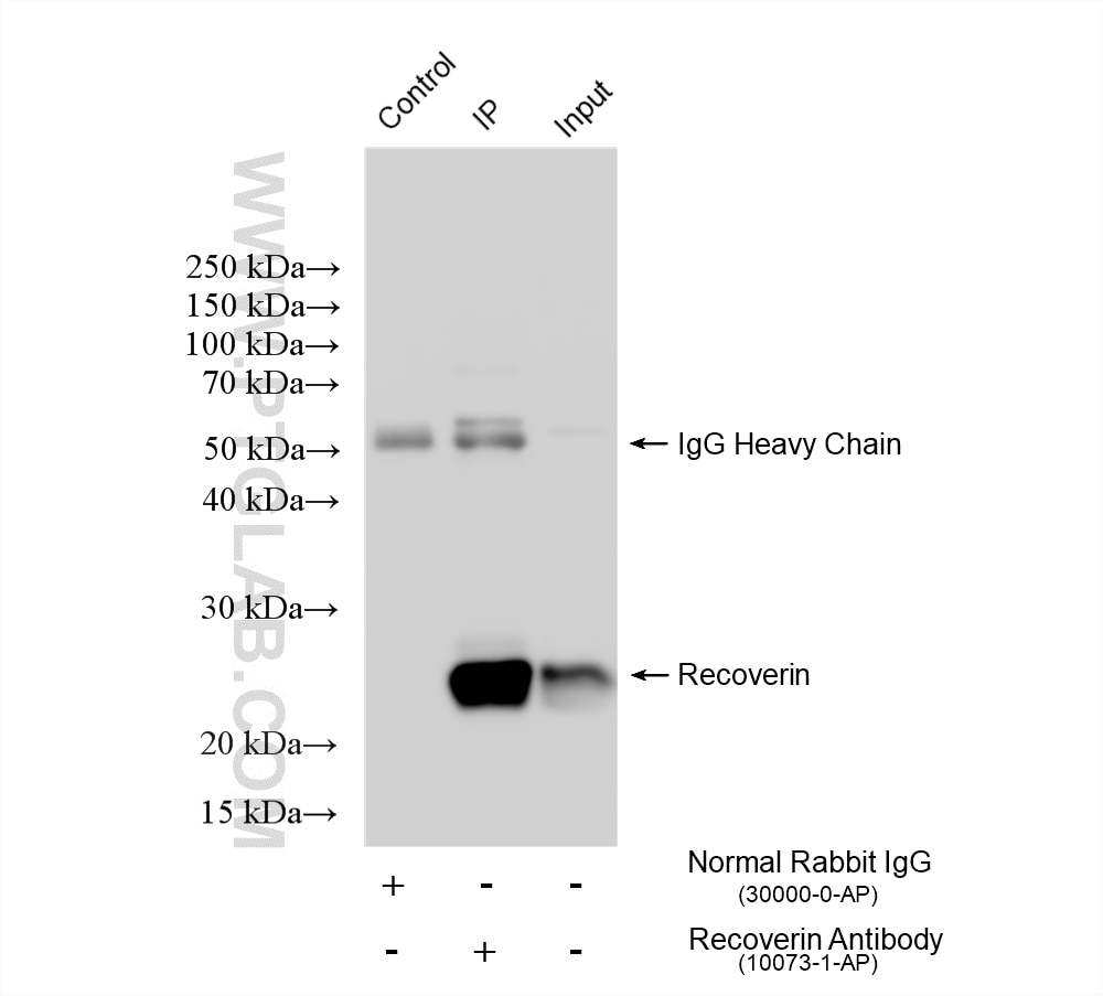 IP experiment of Y79 using 10073-1-AP Immunoprecipitation (IP) experiment of Y79 cells using Recoverin Polyclonal antibody (10073-1-AP)